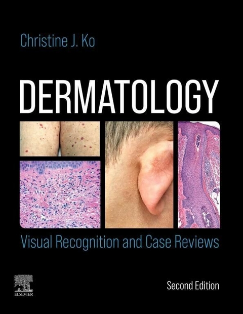 Dermatology: Visual Recognition and Case Reviews E-Book -  Christine Ko