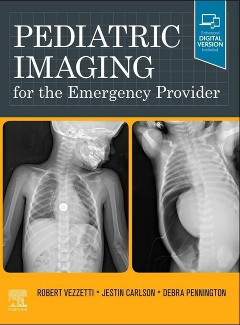 Pediatric Imaging for the Emergency Provider E-Book - 