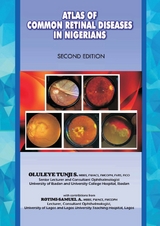 Atlas of Retinal Diseases in Nigerians -  S. Tunji