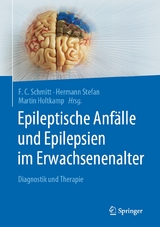 Epileptische Anfälle und Epilepsien im Erwachsenenalter - 