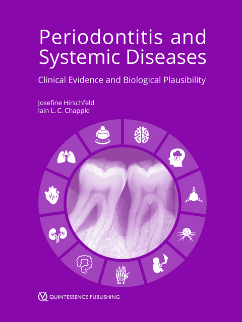 Periodontitis and Systemic Diseases - 