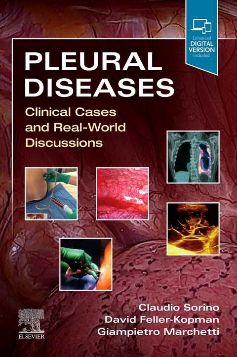 Pleural Diseases,E-Book - 