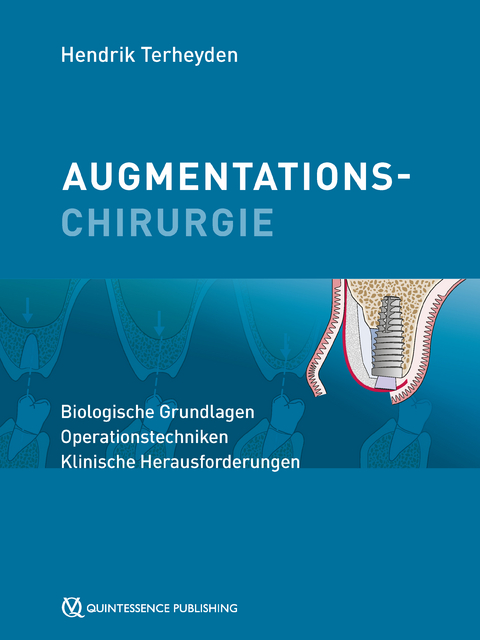 Augmentationschirurgie - Hendrik Terheyden