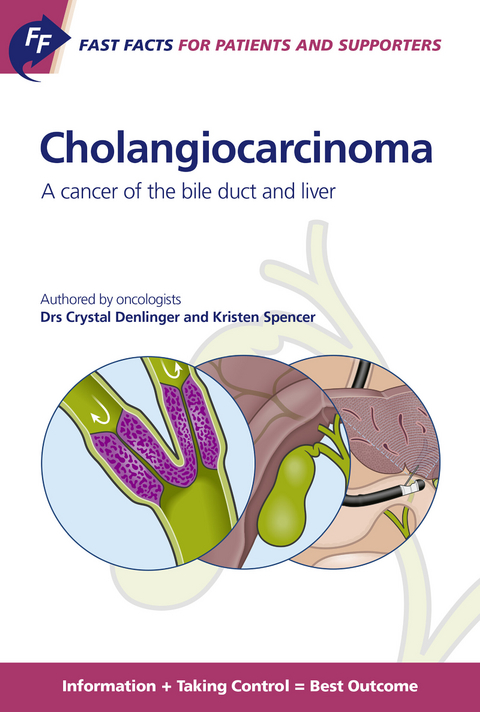 Fast Facts for Patients and Supporters: Cholangiocarcinoma - C. Denlinger, K. Spencer