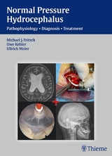 Normal Pressure Hydrocephalus -  Michael J. Fritsch,  Ullrich Meier,  Uwe Kehler