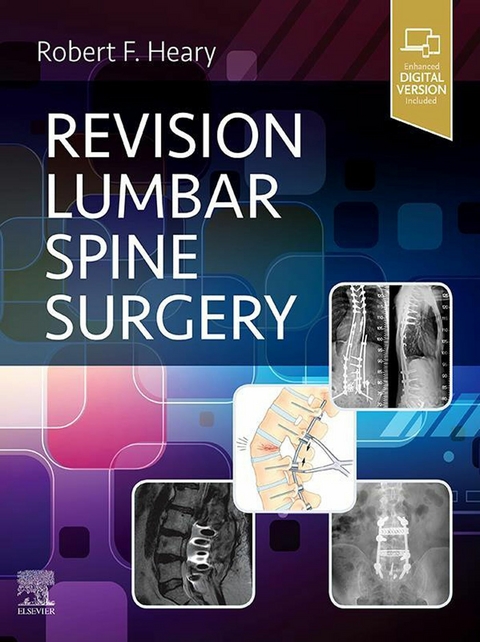 Revision Lumbar Spine Surgery E-Book - 