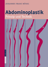 Abdominoplastik - Johannes-Franz Hönig