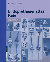 Endoprothesenatlas Knie - Klaus Bläsius