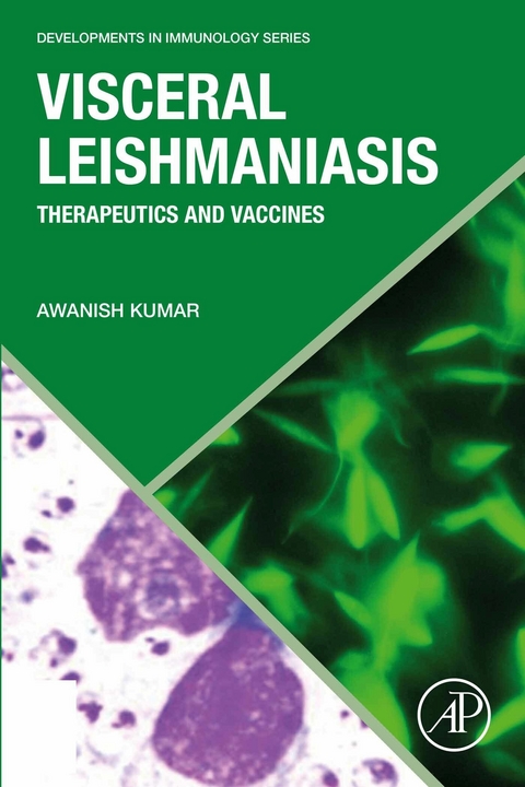 Visceral Leishmaniasis -  Awanish Kumar