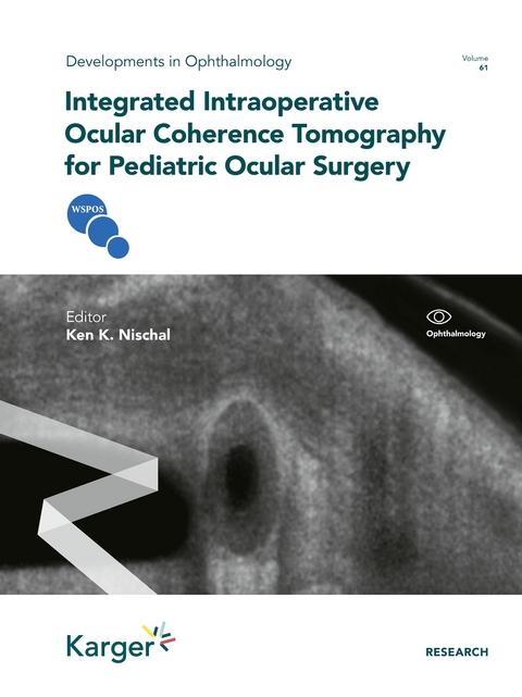 Integrated Intraoperative Ocular Coherence Tomography for Pediatric Ocular Surgery - 