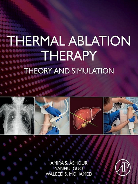 Thermal Ablation Therapy -  Amira S. Ashour,  Yanhui Guo,  Waleed S. Mohamed