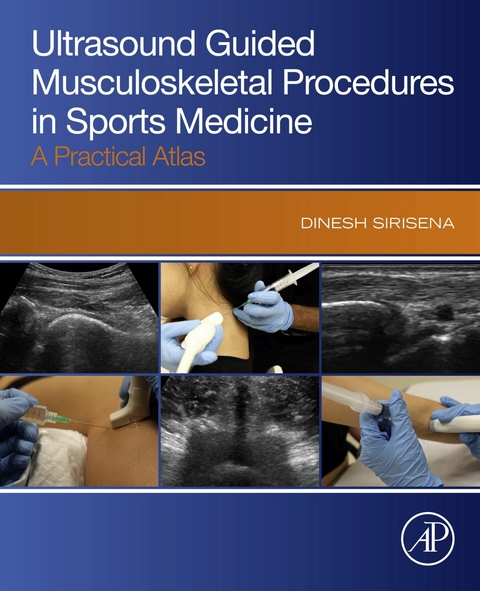 Ultrasound Guided Musculoskeletal Procedures in Sports Medicine -  Dinesh Sirisena