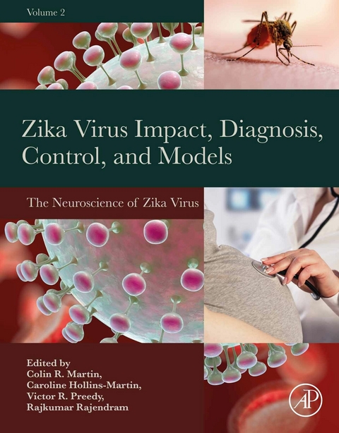 Zika Virus Impact, Diagnosis, Control, and Models - 