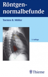 Röntgennormalbefunde - Möller, Torsten B