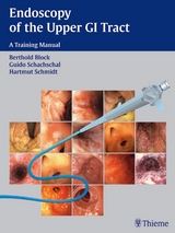 Endoscopy of the Upper GI Tract - Berthold Block, Guido Schachschal, Hartmut H.-J. Schmidt