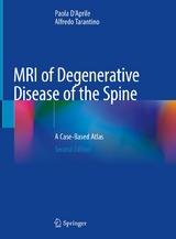 MRI of Degenerative Disease of the Spine - Paola D'Aprile, Alfredo Tarantino