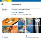 AO Manual of Fracture Management: Internal Fixators - Michael Wagner, Robert Frigg