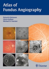 Atlas of Fundus Angiography - 