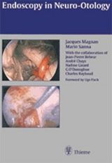 Endoscopy in Neuro-Otology and Skull Base Surgery (AT) - Magnan, Jacques; Magnan, MD, Jacques; Sanna, Mario