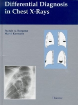 Differential Diagnosis in Chest X-Rays - Francis Burgener, Martti Kormano