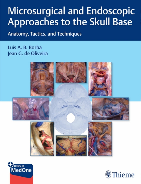 Microsurgical and Endoscopic Approaches to the Skull Base -  Luis Borba,  Jean de Oliveira