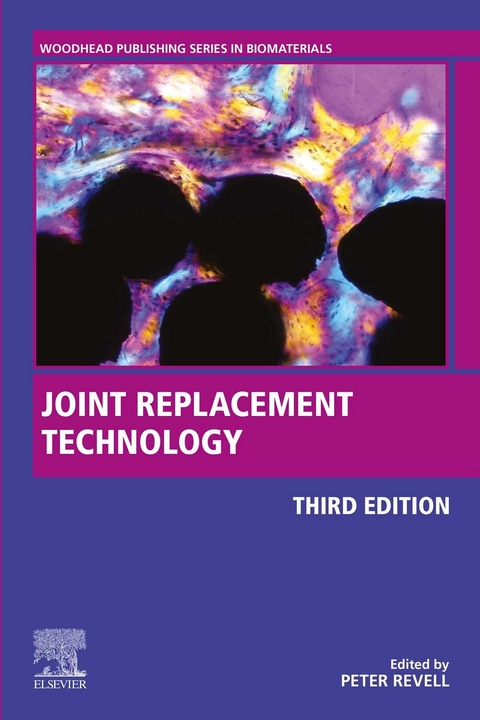 Joint Replacement Technology - 