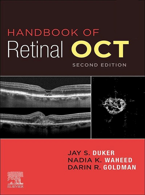 Handbook of Retinal OCT: Optical Coherence Tomography E-Book -  Jay S. Duker,  Nadia K Waheed,  Darin Goldman