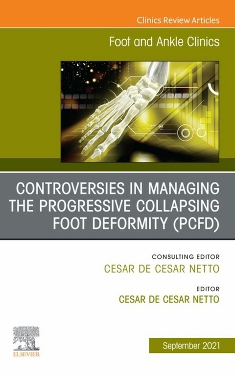 Controversies in Managing the Progressive Collapsing Foot Deformity (PCFD), An issue of Foot and Ankle Clinics of North America, E-Book - 