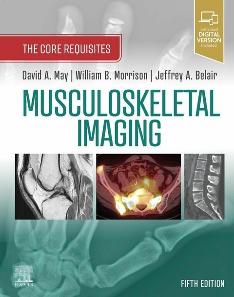 Musculoskeletal Imaging: The Core Requisites E-Book -  Jeffrey A. Belair,  David A. May,  William B. Morrison