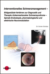 Interventionelles Schmerzmanagement - Günter Schütze