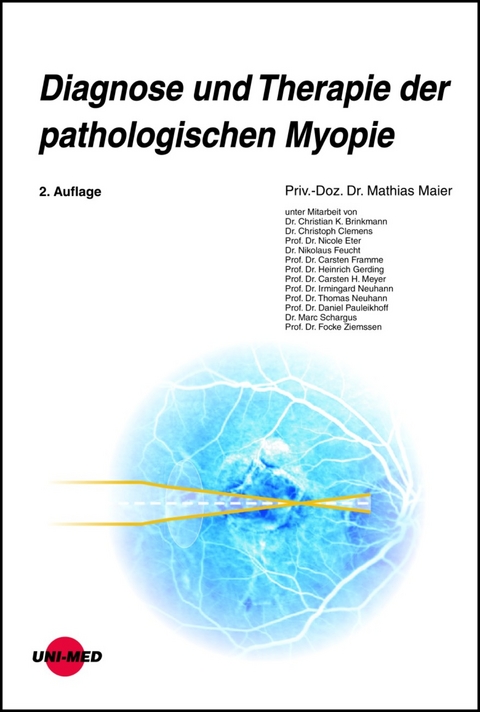 Diagnose und Therapie der pathologischen Myopie - Mathias Maier