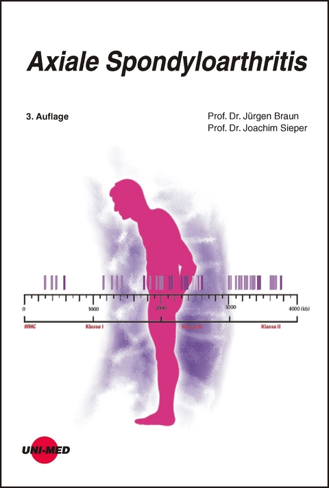 Axiale Spondyloarthritis - Jürgen Braun, Joachim Sieper