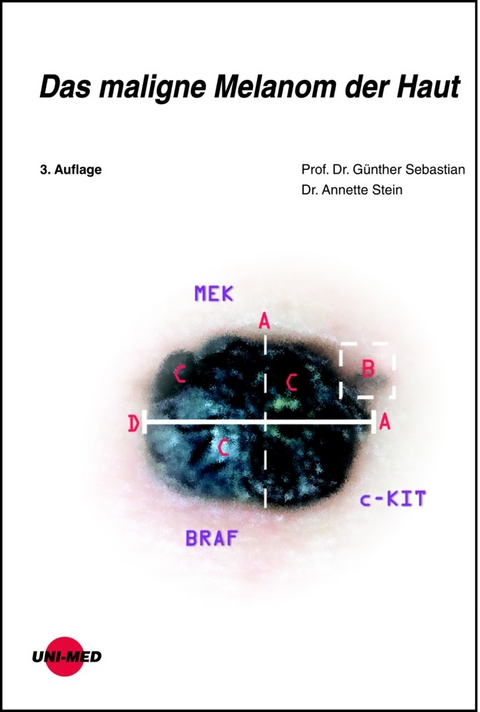 Das maligne Melanom der Haut - Günther Sebastian, Annette Stein