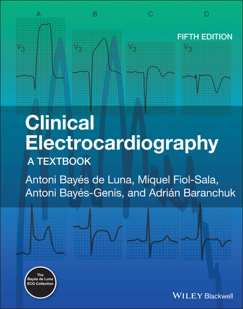 Clinical Electrocardiography - Antoni Bayés de Luna, Miquel Fiol-Sala, Antoni Bayés-Genís, Adrian Baranchuk