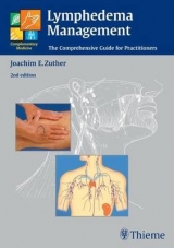 Lymphedema Management - Zuther, Joachim