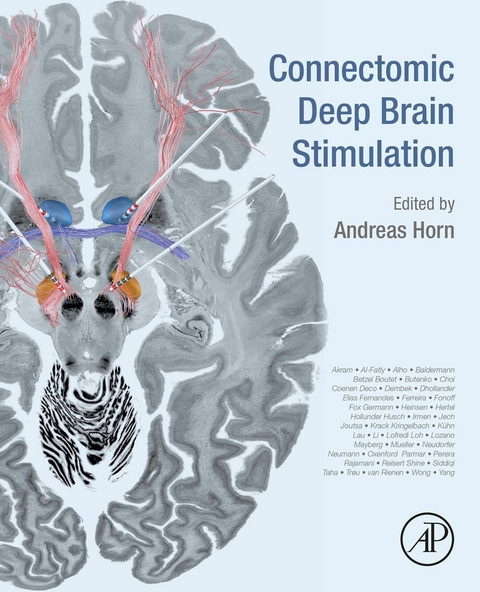 Connectomic Deep Brain Stimulation - 