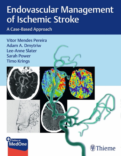 Endovascular Management of Ischemic Stroke -  Vitor Pereira,  Adam Dmytriw,  Lee-Anne Slater,  Sarah Power,  Timo Krings