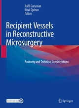 Recipient Vessels in Reconstructive Microsurgery - 