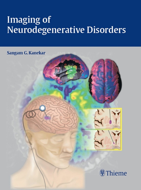 Imaging of Neurodegenerative Disorders - 