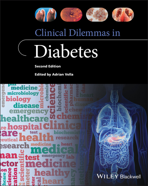 Clinical Dilemmas in Diabetes - 