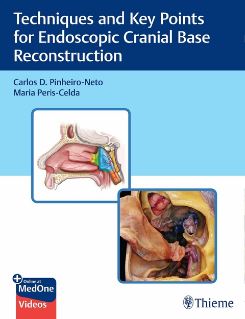 Techniques and Key Points for Endoscopic Cranial Base Reconstruction -  Carlos Pinheiro-Neto,  Maria Peris-Celda