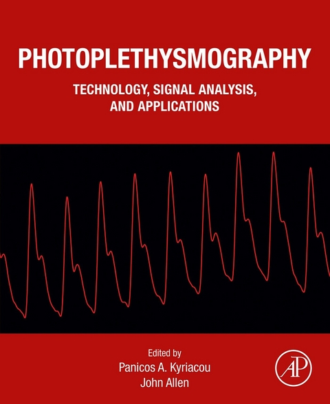 Photoplethysmography - 