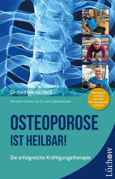 Osteoporose ist heilbar! -  Dr. med. Martin Weiß