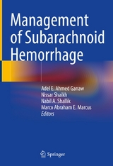 Management of Subarachnoid Hemorrhage - 