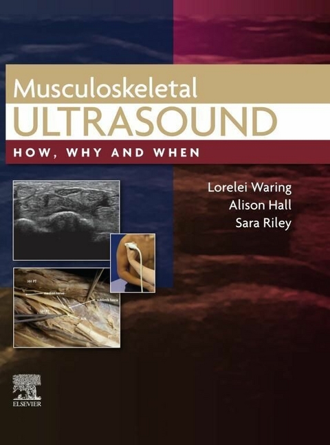 Musculoskeletal Ultrasound, E-Book -  Lorelei Waring,  Alison Hall,  Sara Riley