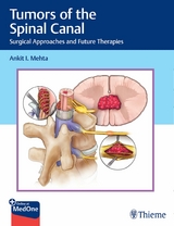 Tumors of the Spinal Canal -  Ankit I. Mehta