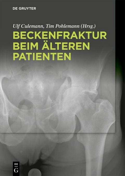 Beckenfraktur beim älteren Patienten - 