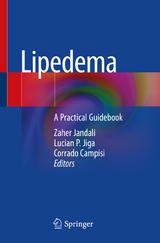 Lipedema - 