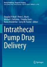 Intrathecal Pump Drug Delivery - 