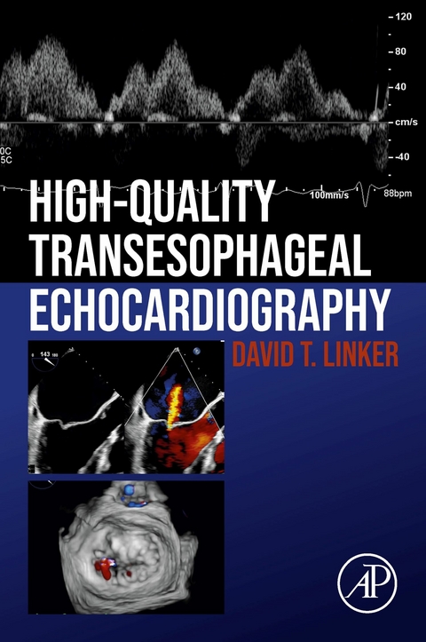 High-Quality Transesophageal Echocardiography -  David T. Linker